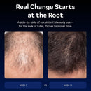 BlueForce Follifusion Hair Microinfusion System – With Copper Peptide Serum Infinity Warehouse