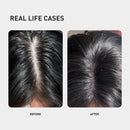 KINTOR 0.5% KX-826 Hair Growth Spray DHT Blocker Hair Regrowth Products,Nourish Hair follicles,Hair Oil Control Products For Men&Women-1 Month Supply 60ml Infinity Warehouse