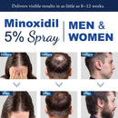 5% Minoxidil for Men Hair Growth Spray for Men and Women (180ml) Infinity Warehouse
