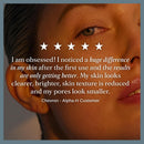 Alpha-H Liquid Gold Exfoliating Treatment 5% Glycolic Acid - Brighten, Even Tone, Smooth Texture, Reduce Appearance of Fine Lines - At-Home Skin Renewal for All Skin Types Infinity Warehouse