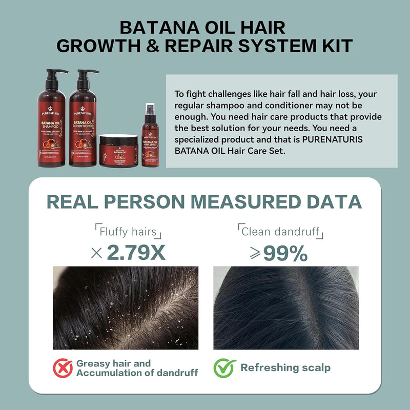 100% Natural Raw Organic Batana Oil Sulfate-Free Complete Hair Growth , Anti-Hair Loss & Repair System Kit – Shampoo, Conditioner, Hair Mask, & Leave-In Spray | Thickness & Prevents Loss for Men Women Infinity Warehouse