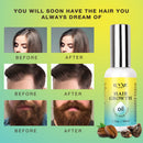 Luv Me Care Biotin Hair Growth Oil Hair Growth Serum for Thicker Longer Fuller Healthier Hair, Prevent Hair Loss & Thinning, All Natural Vitamin Rich Treatment, Women & Men, All Hair Types 1.7 oz Luv Me Care