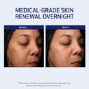 Obagi Medical Retinol + PHA Refining Night Cream - Clinically Proven, Dual-Action, Overnight Anti-Aging Face Cream for Smoother, Renewed Skin & a More Even-Looking Complexion - 1.7 Oz Infinity Warehouse