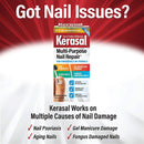 Kerasal Multi-Purpose Nail Repair, Nail Solution for Discolored and Damaged Nails, 0.43 fl oz Kerasal