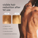 NEW Nood™ Flasher Pro — IPL Laser Hair Removal Device for Women & Men with Sapphire Cooling — Pain-free & Permanent, Visible Results After First Use & Works Everywhere Hair Grows — Gloss White Infinity Warehouse