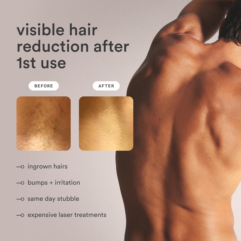 NEW Nood™ Flasher Pro — IPL Laser Hair Removal Device for Women & Men with Sapphire Cooling — Pain-free & Permanent, Visible Results After First Use & Works Everywhere Hair Grows — Gloss White Infinity Warehouse