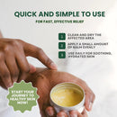 KESMEDIK Tea Tree Oil Balm for Skin, Soothes Itching, Rashes & Dry Skin, Antifungal Defense for Athlete’s Foot, Jock Itch, Chafing, Bug Bites & Eczema, Natural, Effective & Safe for All Ages Infinity Warehouse