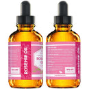 Rosehip Seed Oil by Leven Rose, 100% Pure Unrefined Cold Pressed Anti Aging Rose Hip Moisturizer for Hair Skin & Nails, 1 Fl. Oz… Leven Rose