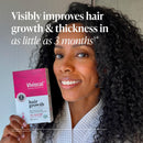 Viviscal Hair Growth Supplements For Women For Thicker, Fuller Hair, Nourishes Thinning & Loss, With Proprietary Collagen Complex, 60 Tablets, 1 Month Supply Infinity Warehouse