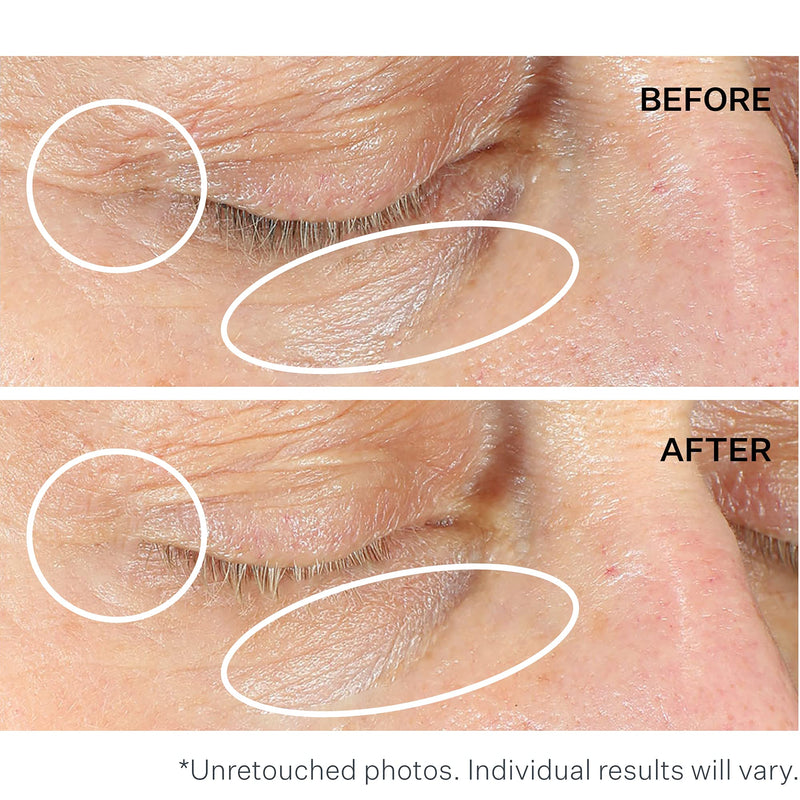 StriVectin Anti-Wrinkle Intensive Eye Cream Concentrate for Wrinkles PLUS, Targets Crow's Feet, Firmness, Puffiness & Dark Circles, 1 Fl oz StriVectin