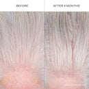 ZENAGEN Densifying Hair Serum for Fine + Thinning Hair | Boosts Hair Density, Strengthens & Nourishes Hair Follicles, Non-Greasy Water-Based Formula, Plant-Based, Vegan, All Hair Types Infinity Warehouse