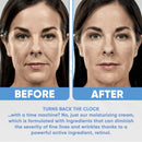 Face Moisturizer 2,5% Organic Retinol Cream for Day & Night with Hyaluronic Acid - Best Facial Age Defying Solution for Anti Aging, Wrinkles & Fine Lines to Restore Elasticity ESTETIST Store