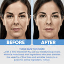 Face Moisturizer 2,5% Organic Retinol Cream with Hyaluronic Acid - Anti Aging, Wrinkles & Fine Lines ESTETIST