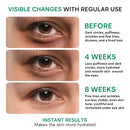 REMEDIAL PAX Eye Cream for Dark Circles and Puffiness, Bags Under Eyes Treatment, Anti-Aging Collagen Eye Cream for Wrinkles, Day & Night Caffeine Eye Cream with Niacinamide Dimethicone - Infinity Warehouse