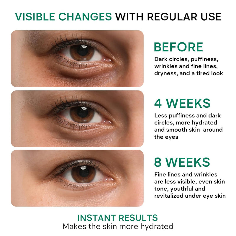 REMEDIAL PAX Eye Cream for Dark Circles and Puffiness, Bags Under Eyes Treatment, Anti-Aging Collagen Eye Cream for Wrinkles, Day & Night Caffeine Eye Cream with Niacinamide Dimethicone - Infinity Warehouse