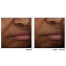 RoC Multi Correxion Revive + Glow Vitamin C Face Moisturizer, Anti-Aging Gel Cream, Hypo-Allegenic & Oil-Free Skin Care, 1.7 Ounce RoC