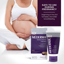 Mederma Stretch Marks Therapy - Help Prevent and treat Stretch Marks -