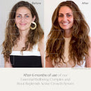 Root Replenish Active Growth Hair Serum with Redensyl DHT Blockers, Resveratrol & Scalp Microbiome Support for Thicker, Fuller-Looking Hair, Lightweight Water-Based Formula, 40mL Infinity Warehouse