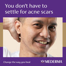 Mederma Acne Scar Serum, Triple-Action Formula with Niacinamide, 1 Fl Oz Infinity Warehouse