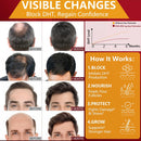 DHT Blocker for Men | Extra Strength Saw Palmetto & Biotin Hair Growth Supplement - Hair Growth Vitamins - Hair Regrowth - Natural Hair Loss Supplements for Men - Proprietary Herbal Blends,1 Pack Infinity Warehouse