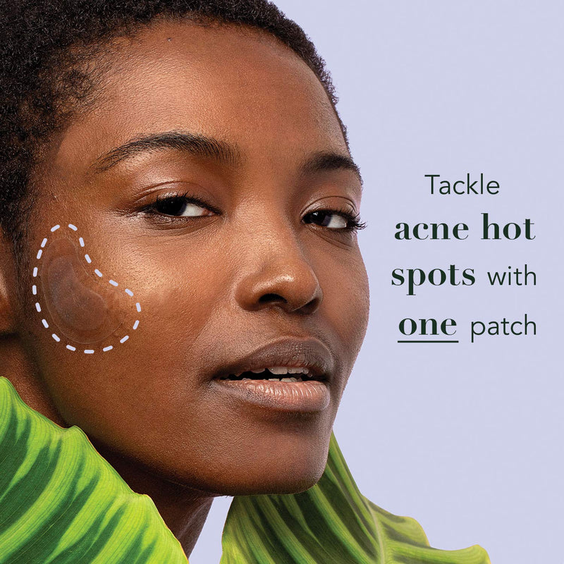 Rael Miracle Large Spot Control Cover - Long Size, Hydrocolloid Strip for Breakouts, Extra Coverage Acne Patch (10 Count) Rael