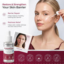 Rosacea Treatment for Face Anti-Redness Serum 30 mL / 1.01 fl oz Infinity Warehouse