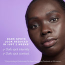 Estée Lauder Perfectionist Pro Rapid Brightening Treatment Face Serum with Ferment3 + Vitamin C | Targets Dark Spots Infinity Warehouse