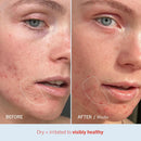 First Aid Beauty - Ultra Repair Cream, Intense Hydration Whipped Colloidal Oatmeal, Clinically Proven to Strengthen Skin Barrier in 7 Days & Helps Relieve Eczema, Luxury Moisturizer, 6 oz + Bonus, 2ct Infinity Warehouse
