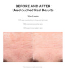 Murad Resurgence Retinol Youth Renewal Night Cream (1.7 oz) and Retinol Youth Renewal Serum (1 oz) - Anti-Aging Serum for Lines & Wrinkles, Retinol Night Cream for Firming and Smoothing Murad