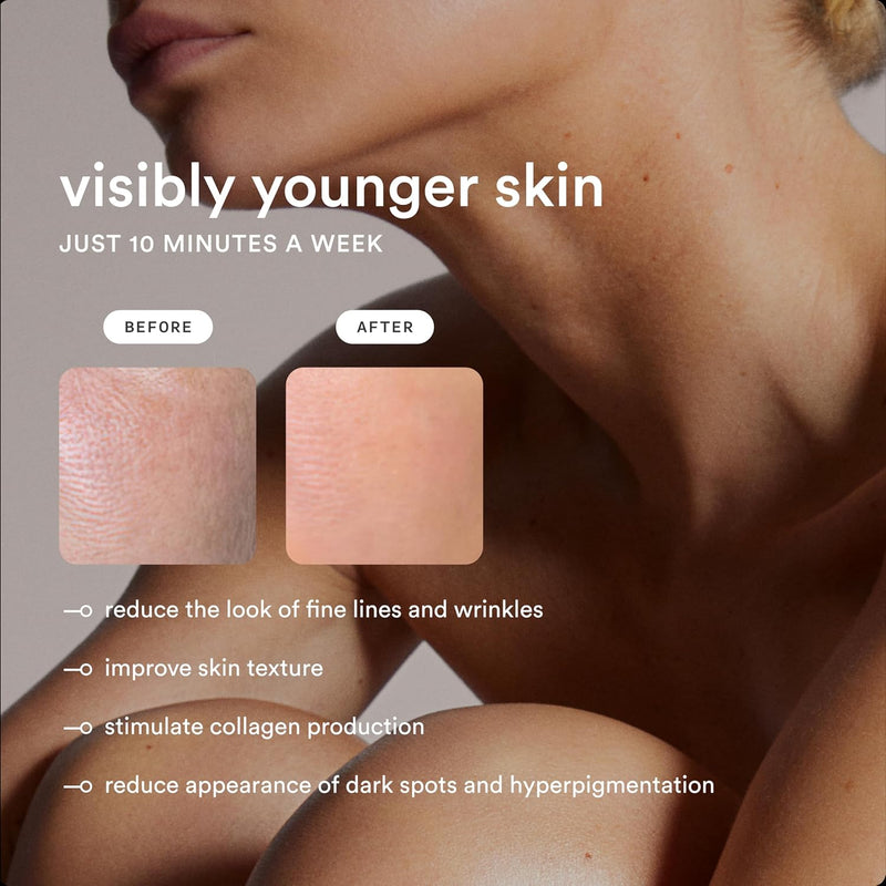 NEW Nood™ Flasher Pro — IPL Laser Hair Removal Device for Women & Men with Sapphire Cooling — Pain-free & Permanent, Visible Results After First Use & Works Everywhere Hair Grows — Gloss White Infinity Warehouse