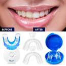VieBeauti Teeth Whitening Kit - 5X LED Light Tooth Whitener with 35% Carbamide Peroxide, Mouth Trays, Remineralizing Gel and Tray Case - Built-In 10 Minute Timer Restores Your Gleaming White Smile VieBeauti