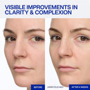 IOPE Expert Vitamin C 25% Antioxidant Serum - 25% Pure Vitamin C Face Serum - Visibly Evens Skin Tone, Enhances Radiance, and Smooths Texture – 5 Antioxidants and PHA - 0.77 fl. oz. Infinity Warehouse