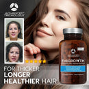 Advanced Trichology FoliGROWTH™ Hair Growth Supplement for Thicker Fuller Hair | Approved* by the American Hair Loss Association | Revitalize Thinning Hair - 90 Count (Pack of 1) Infinity Warehouse