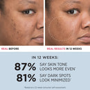 IT Cosmetics Bye Bye Dark Spots 4% Niacinamide Serum - Visibly Reduces Dark Spots & Improves Skin Clarity In 8 Weeks - With 1% Ethyl Vitamin C - For All Skin Types - 1 fl oz It Cosmetics