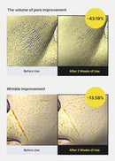 celimax The Vita A Retinol Shot Tightening Serum | with Pure Vitamin A Retinol, Peptide, Pore Minimizer, Wrinkles & Fine Lines, Firmer Skin, Anti-Aging, Skin Smoothing 30ml Infinity Warehouse