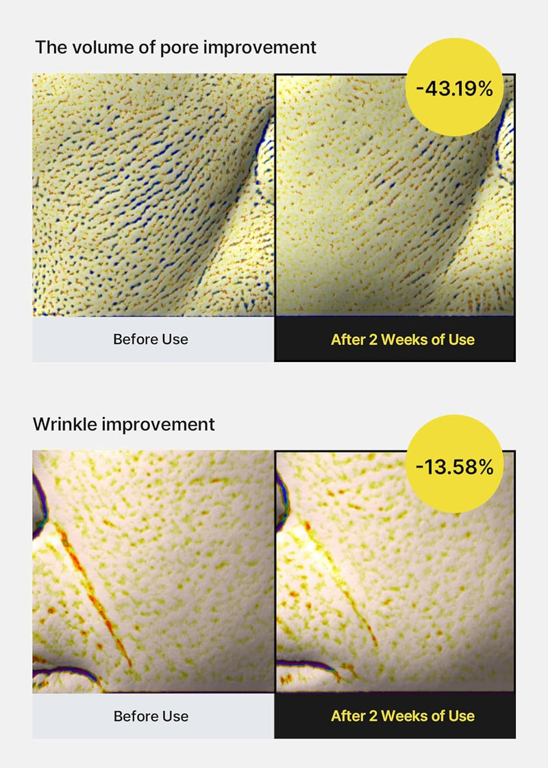 celimax The Vita A Retinol Shot Tightening Serum | with Pure Vitamin A Retinol, Peptide, Pore Minimizer, Wrinkles & Fine Lines, Firmer Skin, Anti-Aging, Skin Smoothing 30ml Infinity Warehouse