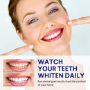 VieBeauti Teeth Whitening Kit - 5X LED Light Tooth Whitener with 35% Carbamide Peroxide, Mouth Trays, Remineralizing Gel and Tray Case - Built-In 10 Minute Timer Restores Your Gleaming White Smile VieBeauti