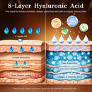 Ultra Hyaluronic Acid Serum for face with 8 Types of HA - 80,000 ppm HA Complex, Matrixyl 3000, Collagen Tri- Complex & Peptides, Multi-Layer Hydration Anti-Aging Face Serum Infinity Warehouse