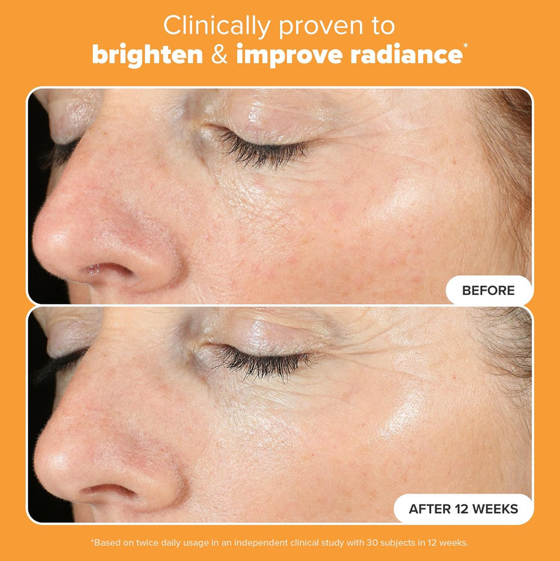 Paula's Choice BOOST C15 Super Booster, 15% Vitamin C Serum for Face, Face Serum with Vitamin E & Ferulic Acid for Discoloration & Glow, Fragrance-Free, 0.67 Fl Oz Infinity Warehouse