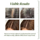 Saw Palmetto Follicle Boost Scalp Serum for Thinning Hair, Clinically Tested Hair & Scalp Treatment, Drug-Free Hormone-Free, Non-Greasy Formula with Peptides, Caffeine & Biotin Infinity Warehouse