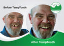 Temptooth