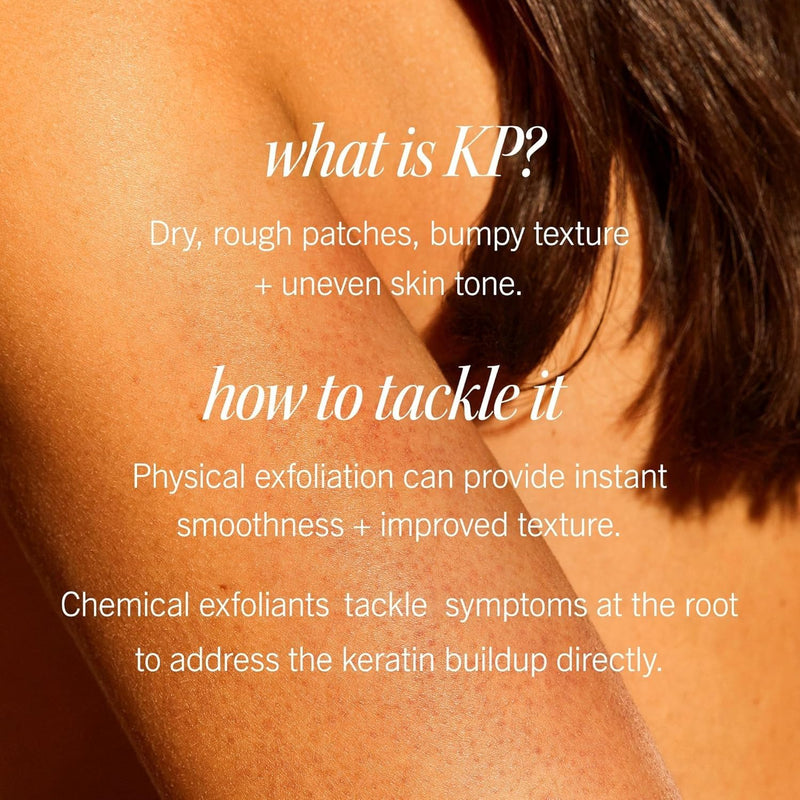First Aid Beauty - KP Bump Eraser Body Scrub with 10% AHA, Keratosis Pilaris Skin Exfoliater with Glycolic and Lactic acids, Helps Reduce Chicken Skin Bumps, Safe for Sensitive Skin, 8 oz, 2ct Infinity Warehouse