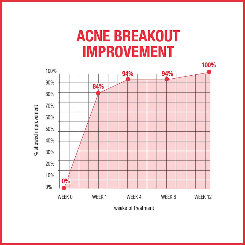 Neutrogena Stubborn Acne AM Face Treatment with 2.5% Micronized Benzoyl Peroxide Acne Medicine, Oil-Free Daily Facial Treatment to Reduce Size & Redness of Breakouts, Paraben-Free, 2 oz Neutrogena