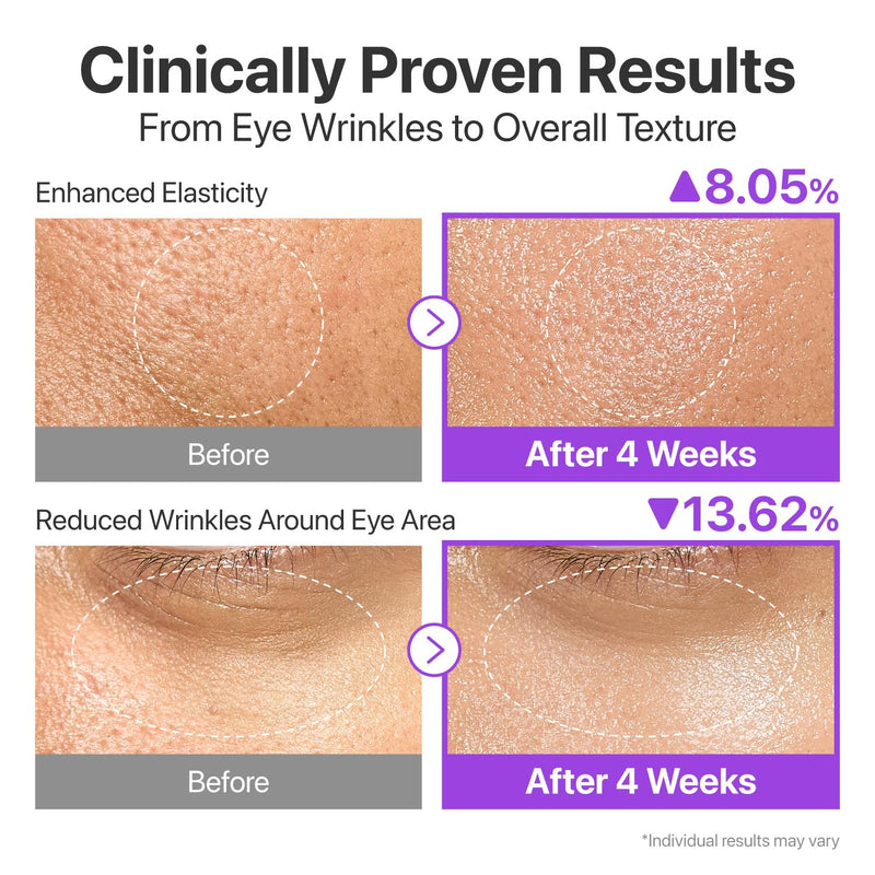 numbuzin No.9 Essence | NAD+ BIO Lifting-sil Essence | Firming, Reduce Wrinkles, Fine Lines | Peptides, NAD+ | Serum for Sagging, Aging, Dull Skin | 1.69 fl. oz. Infinity Warehouse