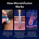 Follifusion Hair Microinfusion System – With Copper Peptide Serum Infinity Warehouse