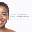 PCA SKIN Hydroquinone-Free Pigment Gel Face Serum - Spot Treatment Facial Corrector with Kojic & Lactic Acid for Brightening Dark Spots & Hyperpigmentation (1 fl oz) PCA SKIN
