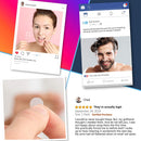 Acne Patches (120 Pack), Hydrocolloid Acne Patch with Tea Tree Oil - Pimple Patches for Face - Zit Patch and Pimple Stickers - Hydrocolloid Acne Dots for Healing Acne with Zit Patches - Acne Treatment KEYCONCEPTS