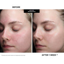 Kate Somerville DeliKate Recovery Serum – Clinically Formulated Hydrating Treatment, Irritation and Redness Relief for Stressed or Sensitive Skin, 1 Fl Oz Infinity Warehouse