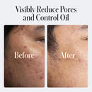 Geologie Daily Face Wash for Sensitive Skin | Fragrance-Free Facial Cleanser for Men & Women | Acne & Oil Control | Non-irritating, Gentle Cleansing & Soothing Face Wash | 2-Pack Infinity Warehouse