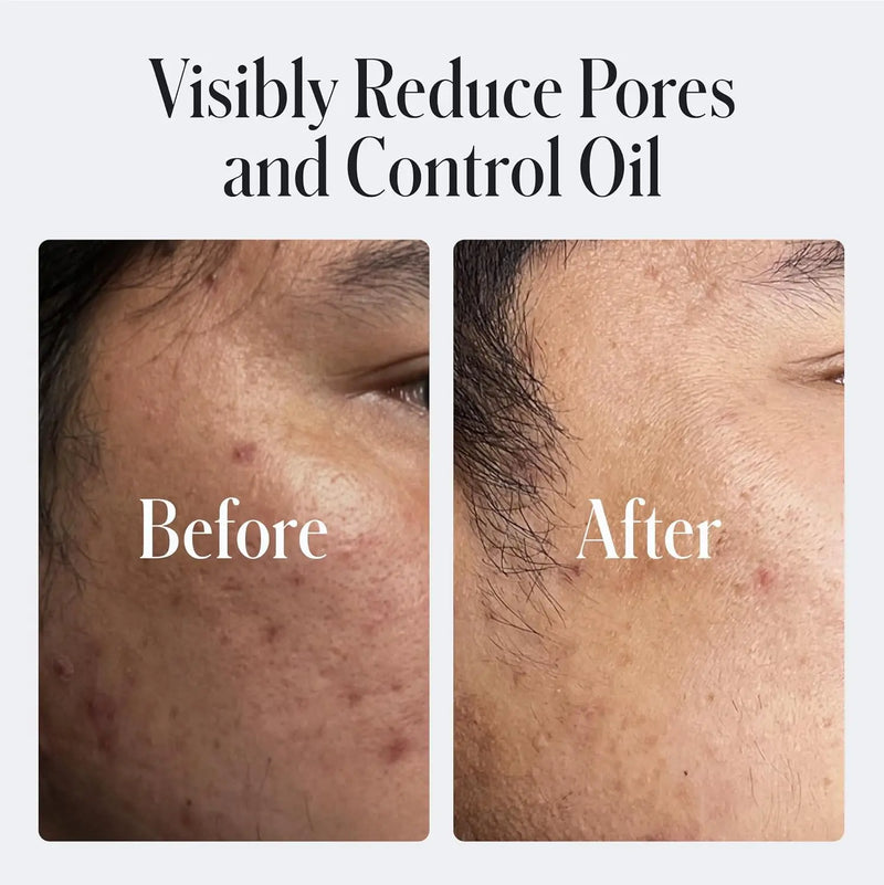 Geologie Daily Face Wash for Sensitive Skin | Fragrance-Free Facial Cleanser for Men & Women | Acne & Oil Control | Non-irritating, Gentle Cleansing & Soothing Face Wash | 2-Pack Infinity Warehouse